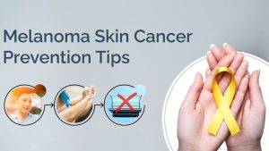 melanoma skin cancer prevention tips