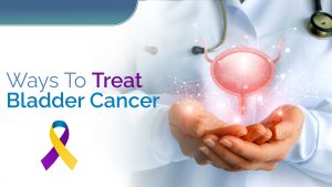 Ways to treat bladder cancer