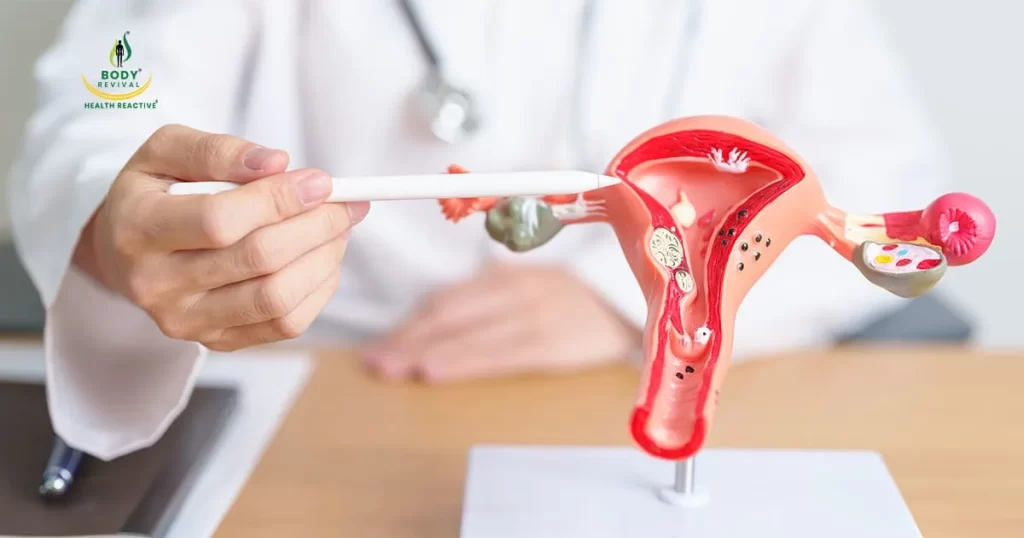 How to safeguard yourself against Cervical Cancer