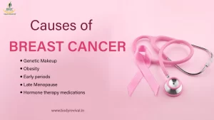 Causes of breast cancer
