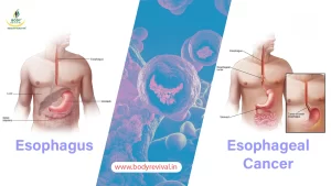 Esophagus and esophageal cancer