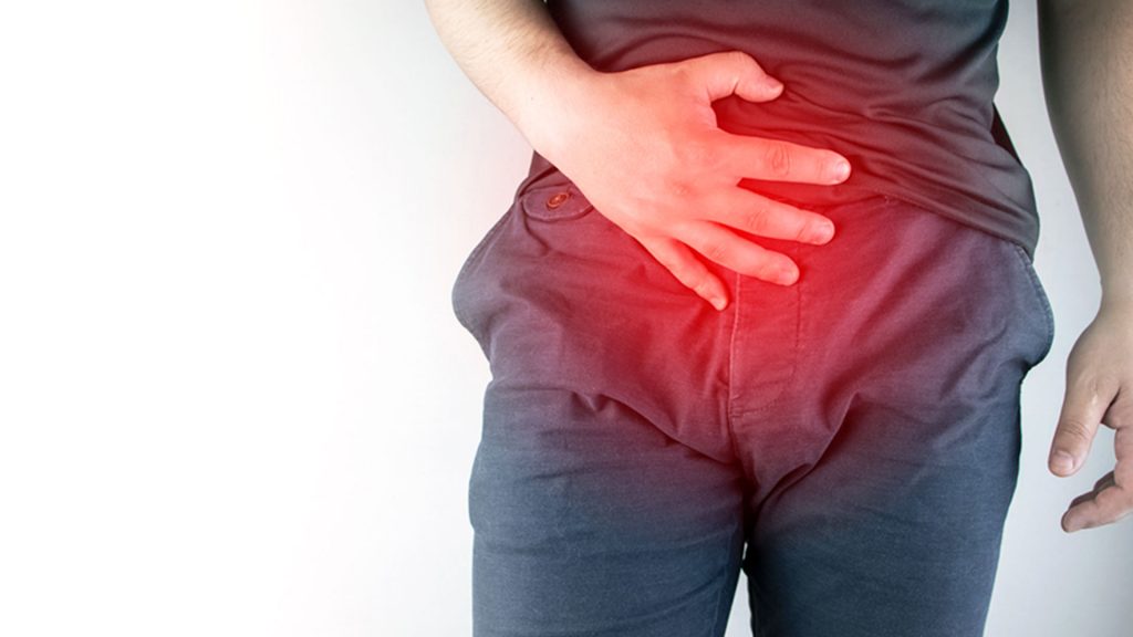 bladder-cancer-symptoms-causes-preventions