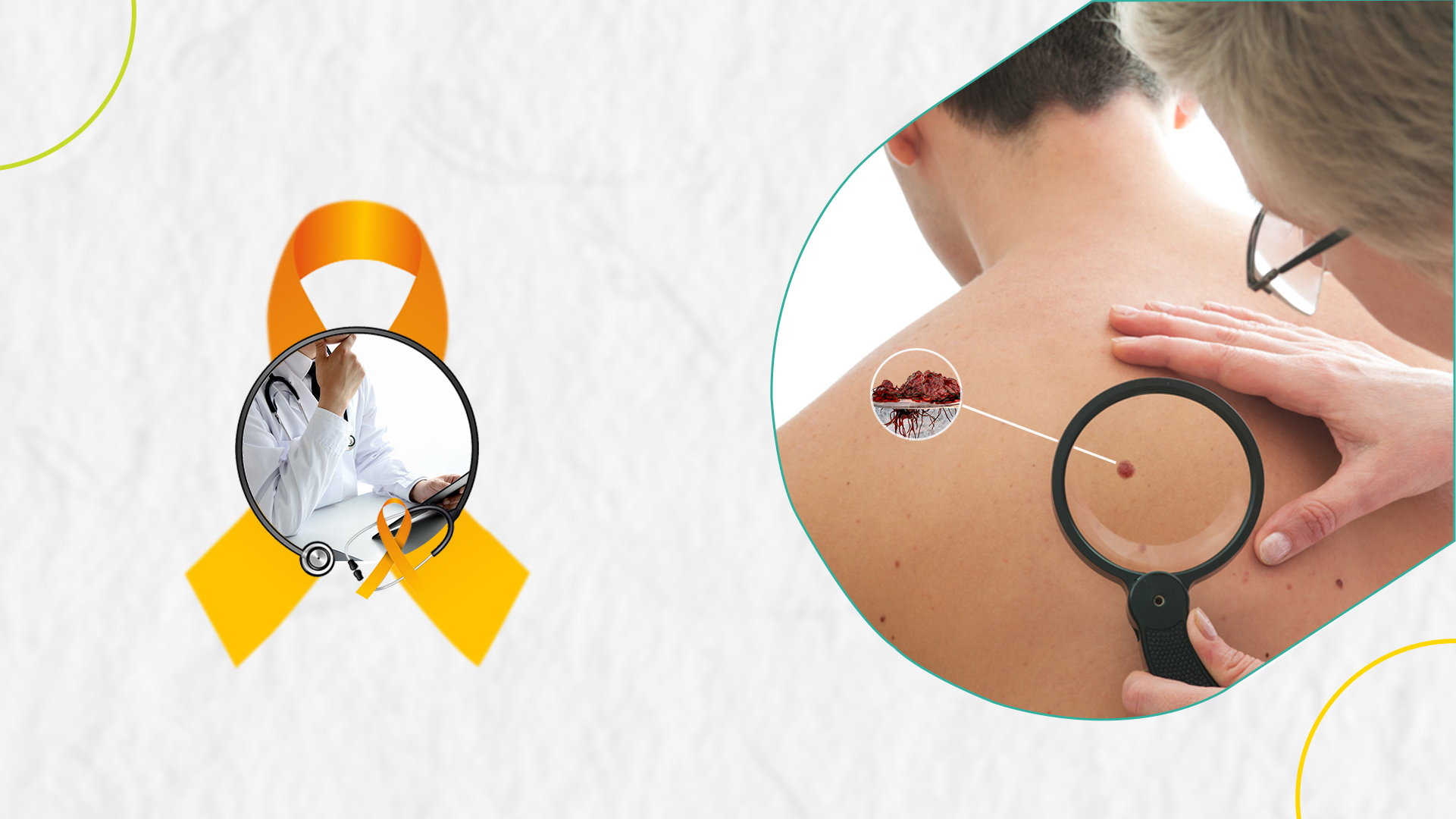 Are-there-alternative-treatments-for-melanoma-skin-cancer