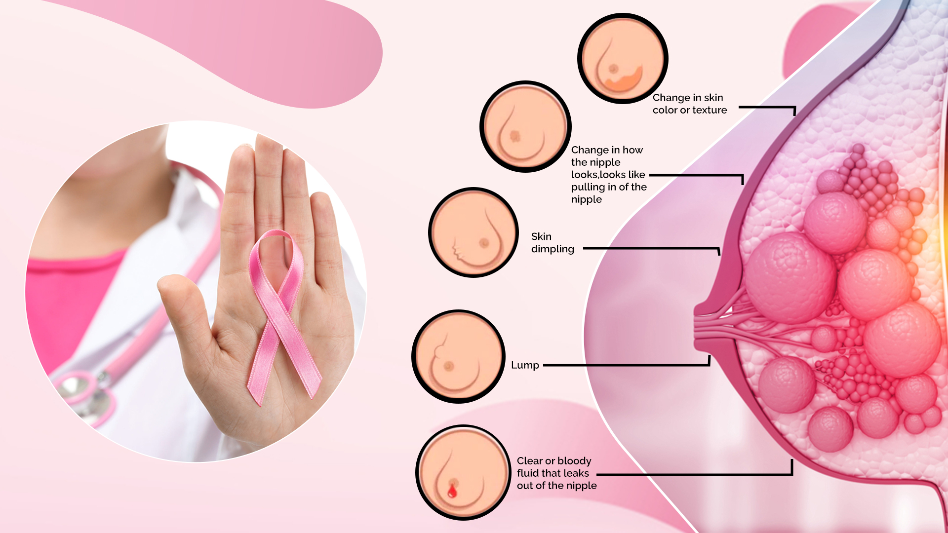 detect breast cancer & its treatment