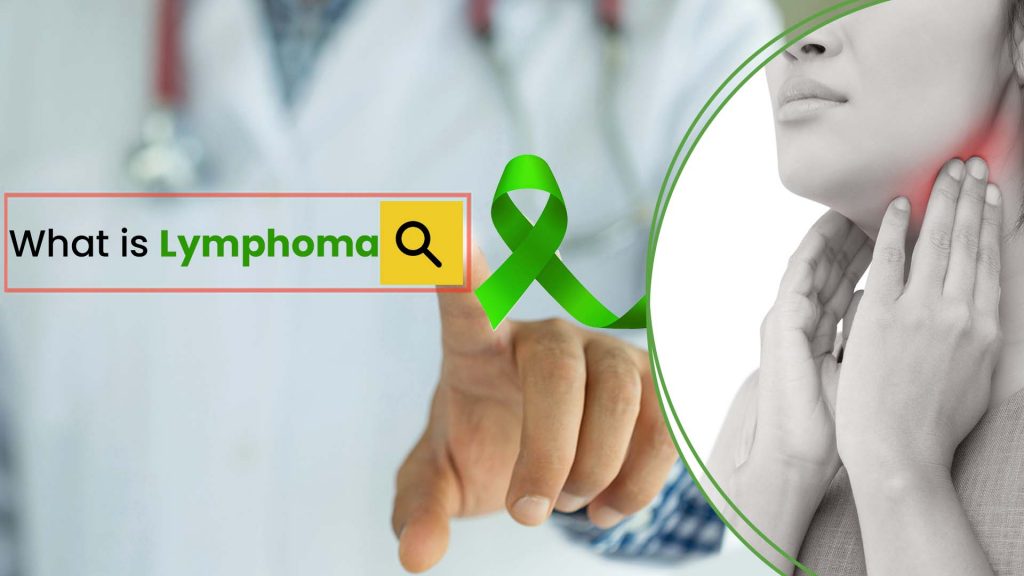 What is lymphoma and why does it occur