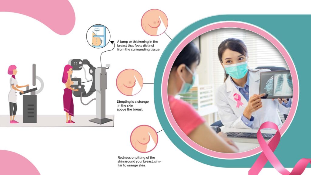 breast cancer screening mammogram