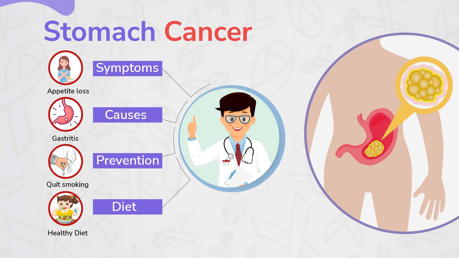 What Is Stomach Cancer 1 