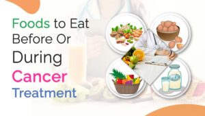 Cancer Diet- foods to eat during and after Cancer Treatment