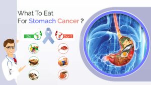 What diet should a stomach cancer patient follow