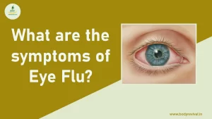 Symptoms of Eye flu