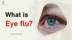 what is eye flu or conjunctivitis