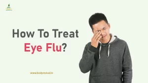 Treatment of Eye flu or conjunctivitis