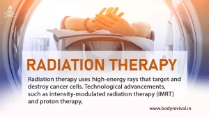 Radiation Therapy for Cancer Patients