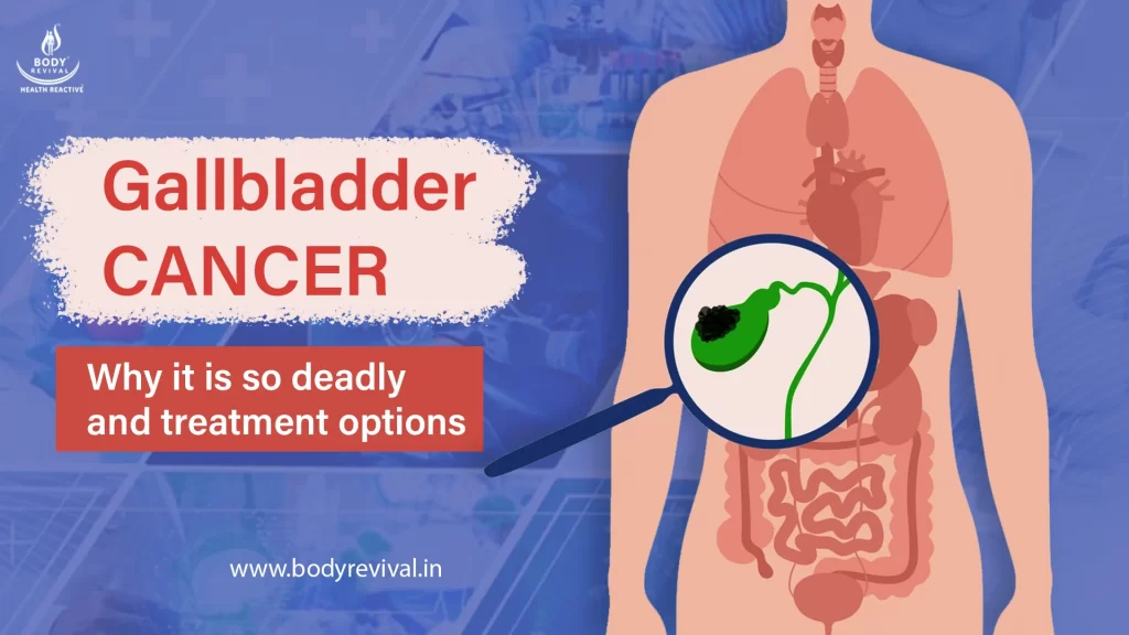 Gallbladder cancer and why it is deadly