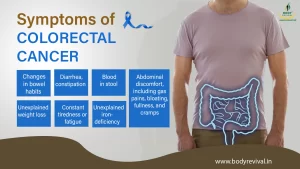 Symptoms of colorectal cancer 