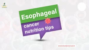 Esophageal cancer nutrition tips