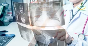 Breakthroughs in Cancer Treatment: A Scientific Achievement 6 AI-Powered Lung Cancer Predictions- Body Revival