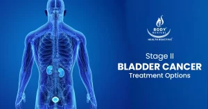 StageII Bladder Cancer Treatment Options