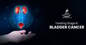 Treating Stage III Bladder Cancer 