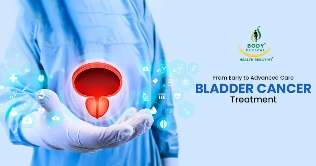 Bladder cancer treatment options according to stages