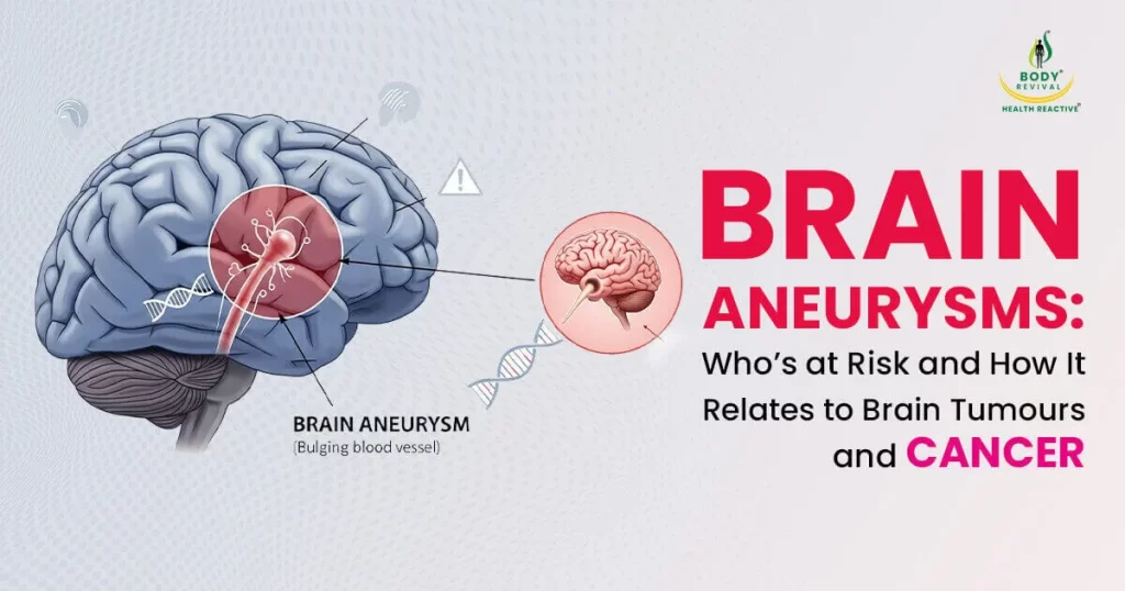 Brain aneurysm and what causes it