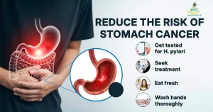 How to reduce risk of stomach cancer