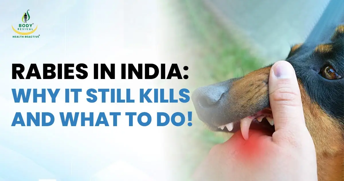 Rabies in India: Why It Still Kills and What to do!