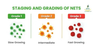 stages of neuroendocrine tumors