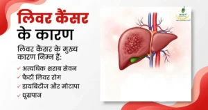 Causes of Liver Cancer bodyrevival