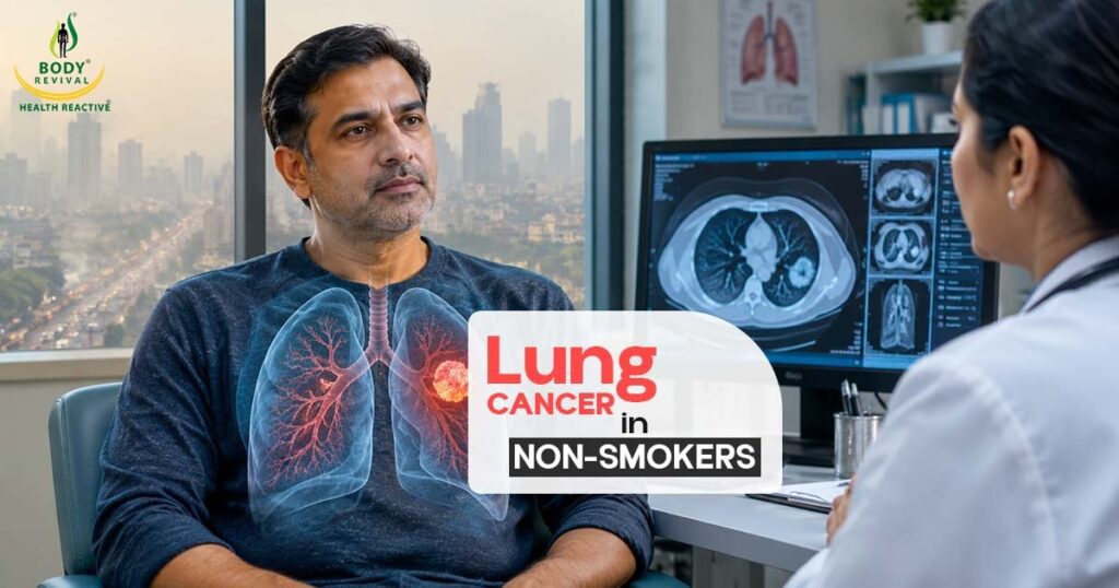 Lung Cancer 1